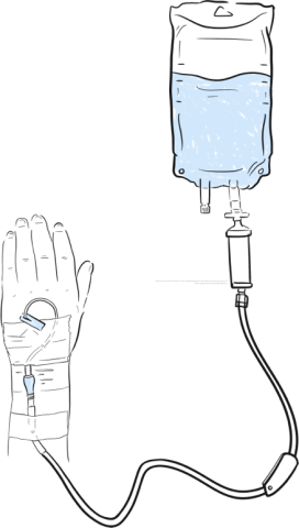 Illustration of IV being administered into a hand